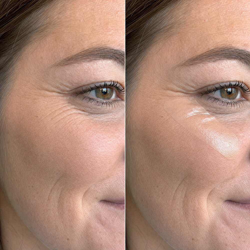 Anti Wrinkle & Scar Tape
